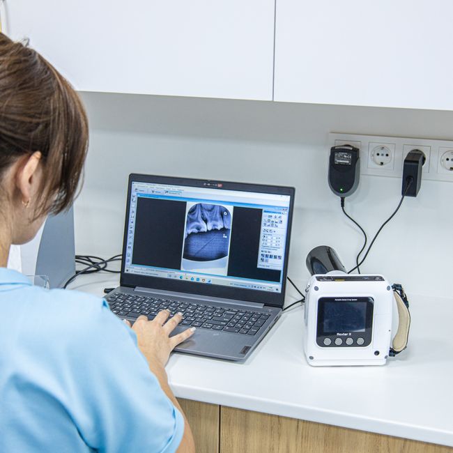 Protetika — slučaj 2: poslije terapije